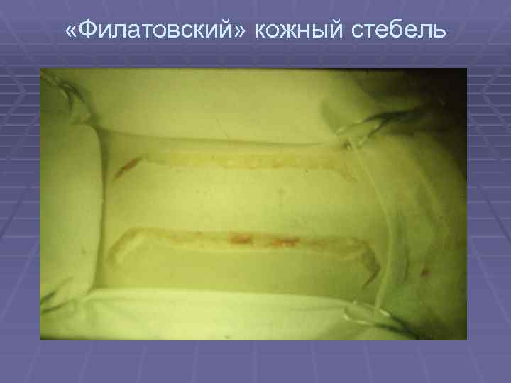  «Филатовский» кожный стебель 