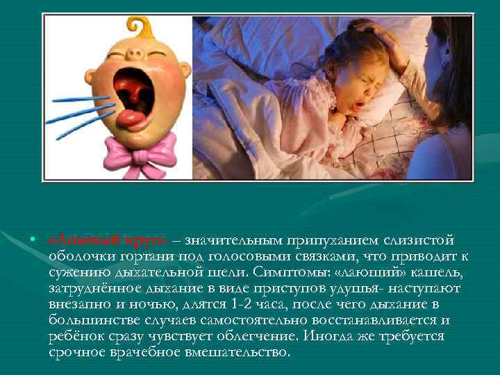  • «Ложный круп» – значительным припуханием слизистой оболочки гортани под голосовыми связками, что