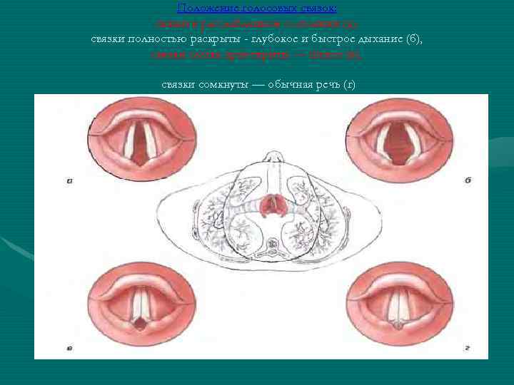 Рак голосовых связок фото