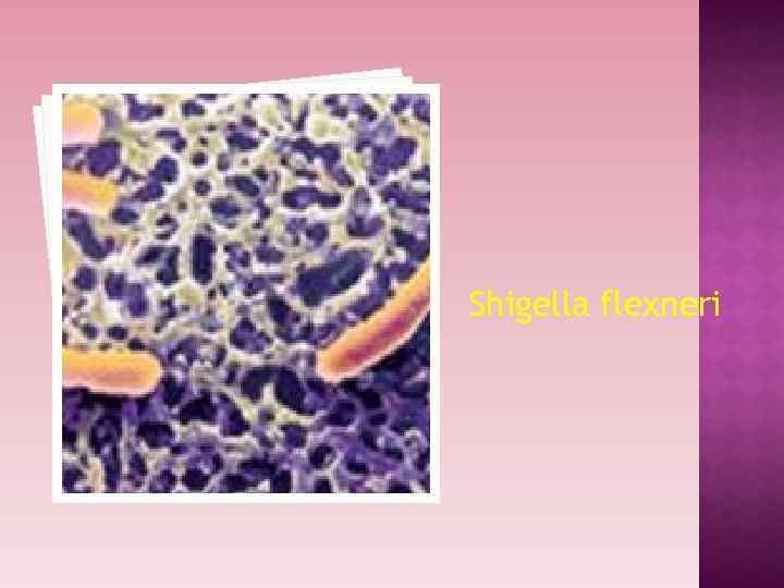 Shigella flexneri 