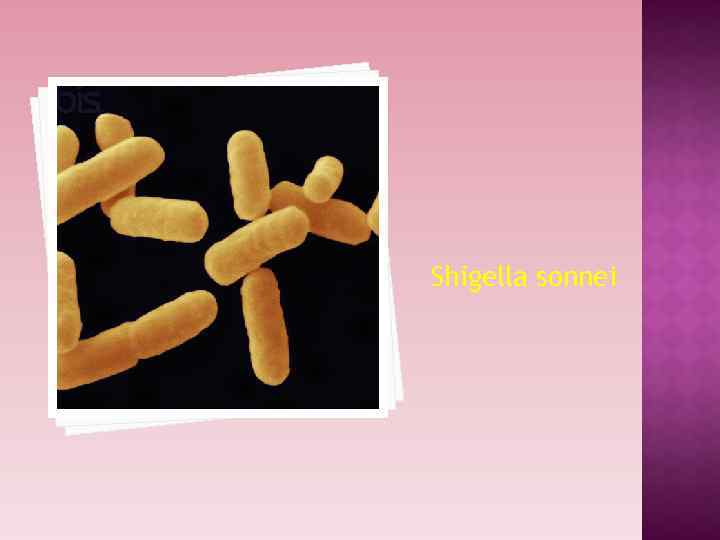 Shigella sonnei 