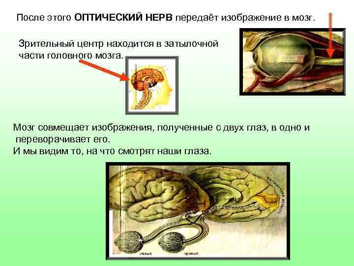 После этого ОПТИЧЕСКИЙ НЕРВ передаёт изображение в мозг. Зрительный центр находится в затылочной части