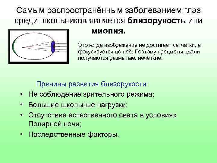 Самым распространённым заболеванием глаз среди школьников является близорукость или миопия. Это когда изображение не