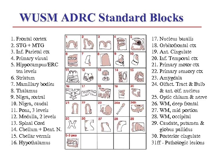 WUSM ADRC Standard Blocks 1. Frontal cortex 2. STG + MTG 3. Inf. Parietal