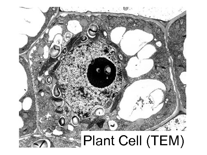 Plant Cell (TEM) 