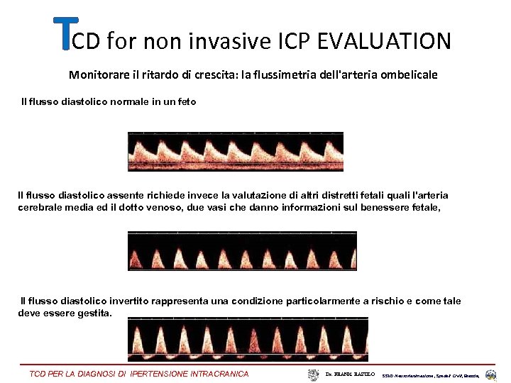 TCD for non invasive ICP EVALUATION Monitorare il ritardo di crescita: la flussimetria dell'arteria