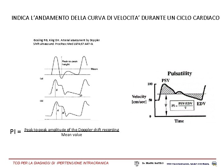 INDICA L’ANDAMENTO DELLA CURVA DI VELOCITA’ DURANTE UN CICLO CARDIACO Gosling RG, King DH.