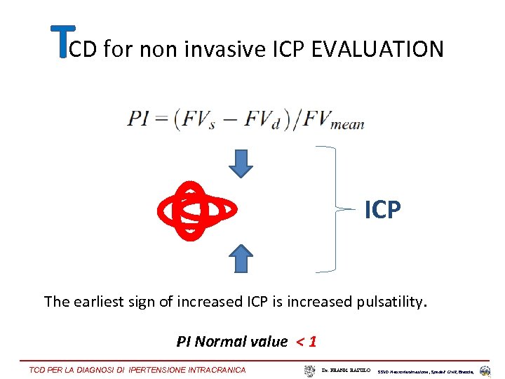 TCD for non invasive ICP EVALUATION ICP The earliest sign of increased ICP is