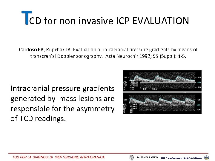 TCD for non invasive ICP EVALUATION Cardoso ER, Kupchak JA. Evaluation of intracranial pressure