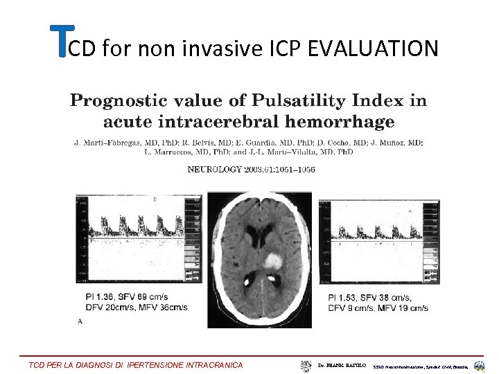 TCD for non invasive ICP EVALUATION TCD PER LA DIAGNOSI DI IPERTENSIONE INTRACRANICA Dr.