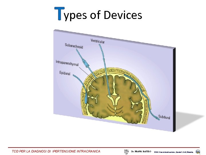 Types of Devices TCD PER LA DIAGNOSI DI IPERTENSIONE INTRACRANICA Dr. FRANK RASULO SSVD