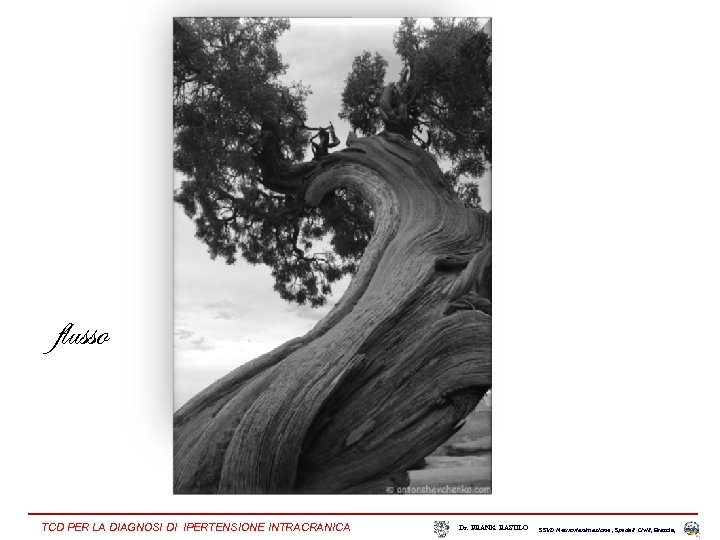 flusso TCD PER LA DIAGNOSI DI IPERTENSIONE INTRACRANICA Dr. FRANK RASULO SSVD Neurorianimazione ,
