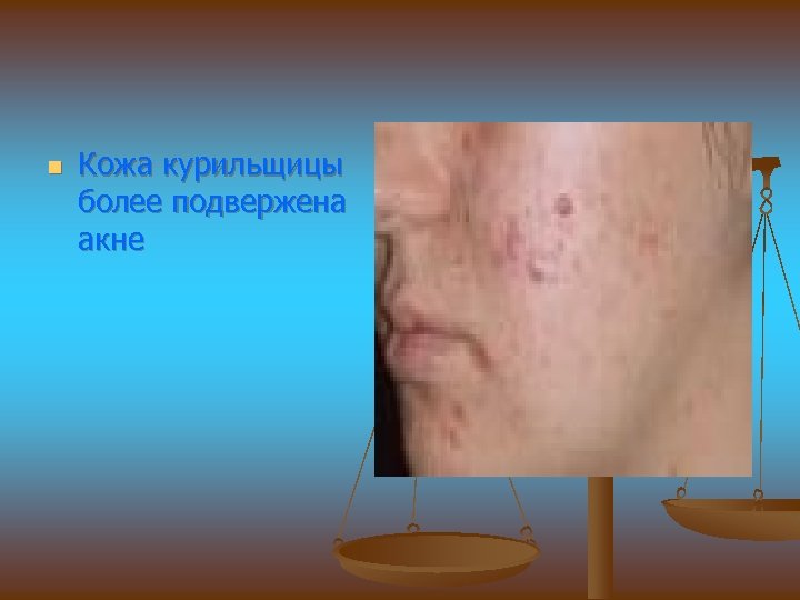 n Кожа курильщицы более подвержена акне 