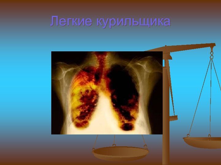 Легкие курильщика 
