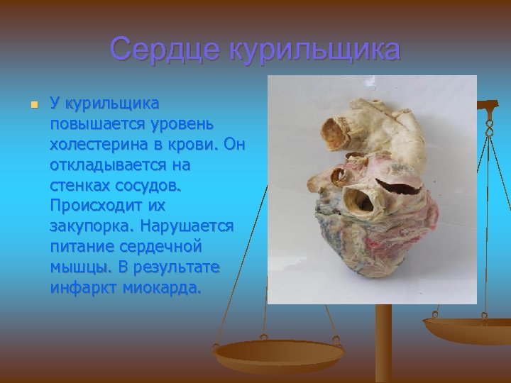 Сердце курильщика n У курильщика повышается уровень холестерина в крови. Он откладывается на стенках