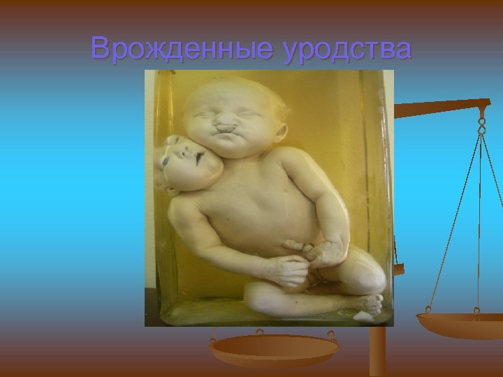 Врожденные уродства 