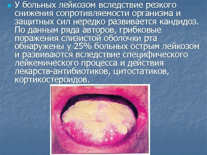  У больных лейкозом вследствие резкого снижения сопротивляемости организма и защитных сил нередко развивается