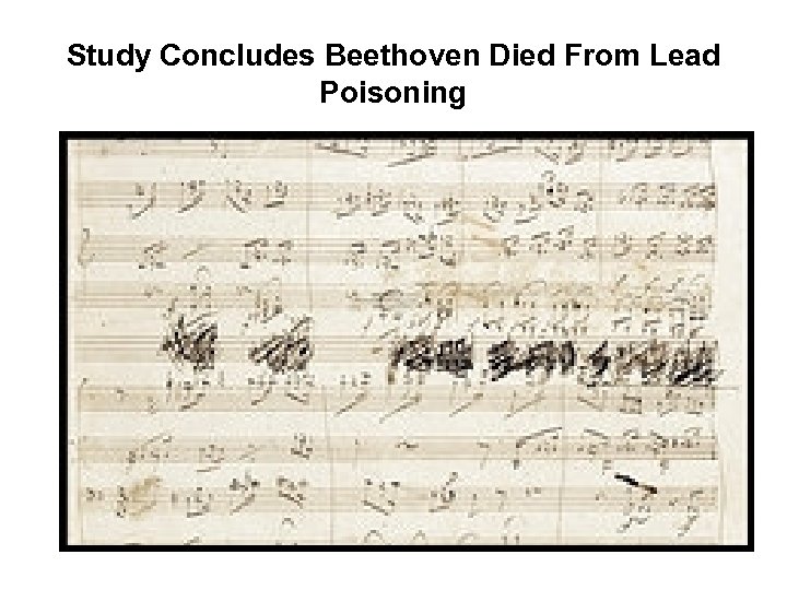 Study Concludes Beethoven Died From Lead Poisoning 