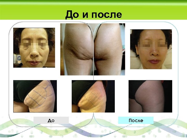 До и после До После 