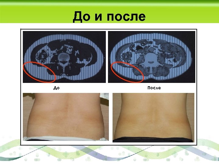 До и после До После 