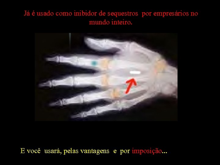 Já é usado como inibidor de sequestros por empresários no mundo inteiro. E você