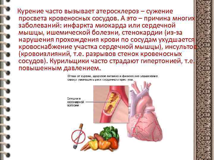 Курение часто вызывает атеросклероз – сужение просвета кровеносных сосудов. А это – причина многих