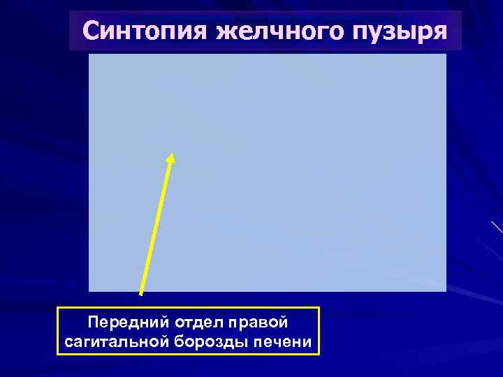 Синтопия желчного пузыря Передний отдел правой сагитальной борозды печени 