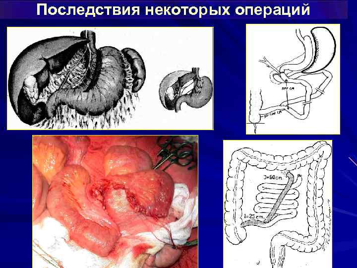 Последствия некоторых операций 