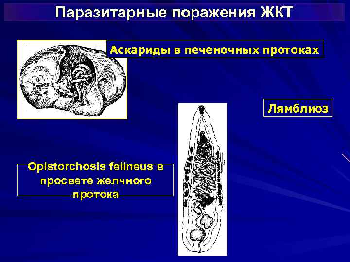 Паразитарные поражения ЖКТ Аскариды в печеночных протоках Лямблиоз Opistorchosis felineus в просвете желчного протока
