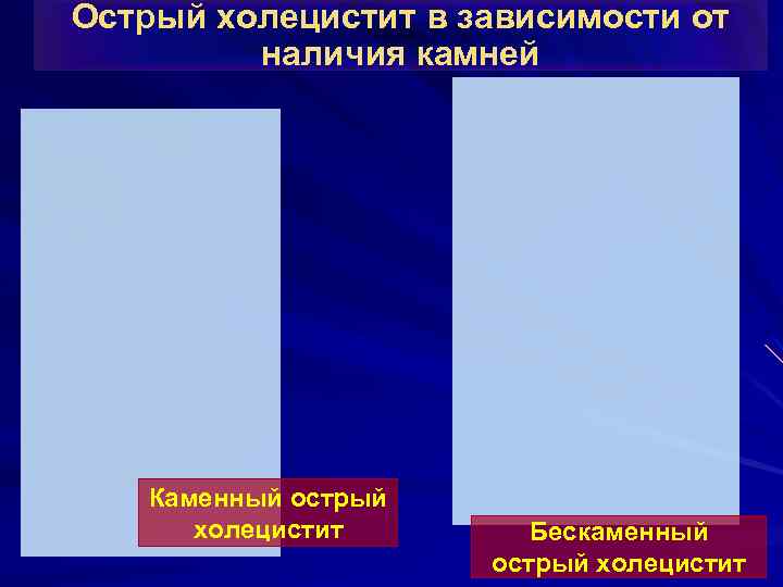 Острый холецистит в зависимости от наличия камней Каменный острый холецистит Бескаменный острый холецистит 