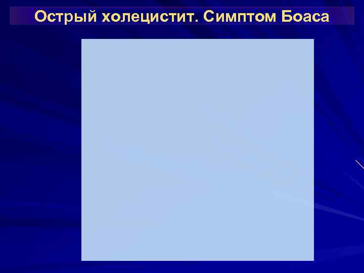 Острый холецистит. Симптом Боаса 