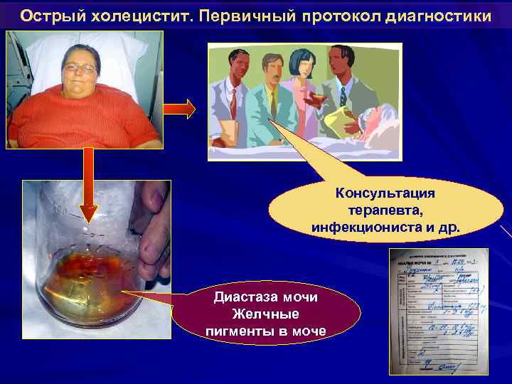 Острый холецистит. Первичный протокол диагностики Консультация терапевта, инфекциониста и др. Диастаза мочи Желчные пигменты