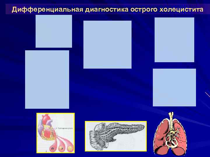 Дифференциальная диагностика острого холецистита 