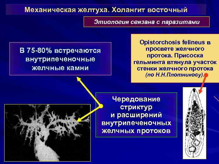 Механическая желтуха. Холангит восточный Этиология связана с паразитами В 75 -80% встречаются внутрипеченочные желчные