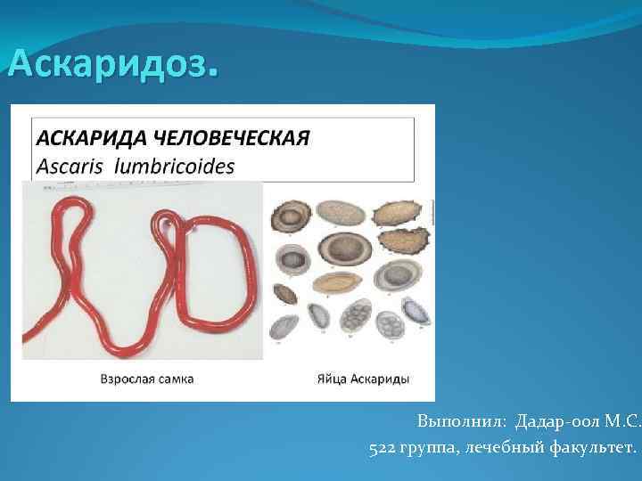 Аскаридоз. Выполнил: Дадар-оол М. С. 522 группа, лечебный факультет. 