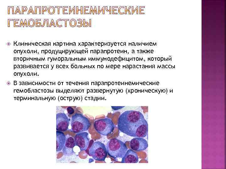  Клиническая картина характеризуется наличием опухоли, продуцирующей парапротеин, а также вторичным гуморальным иммунодефицитом, который