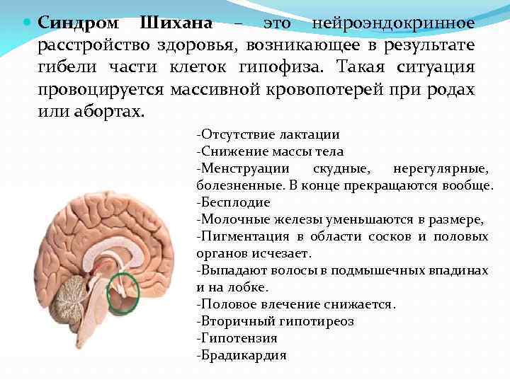  Синдром Шихана – это нейроэндокринное расстройство здоровья, возникающее в результате гибели части клеток