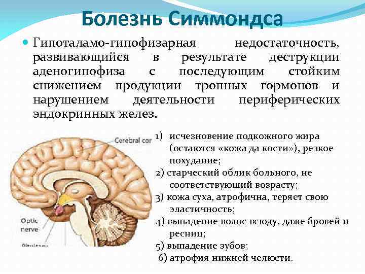 Заболевания гипофиза. Механизм развития гипофизарной кахексии. Болезнь Симмондса патогенез. Гипоталамо-гипофизарная недостаточность. Тотальная гипофункция гипоталамо-гипофизарной системы.