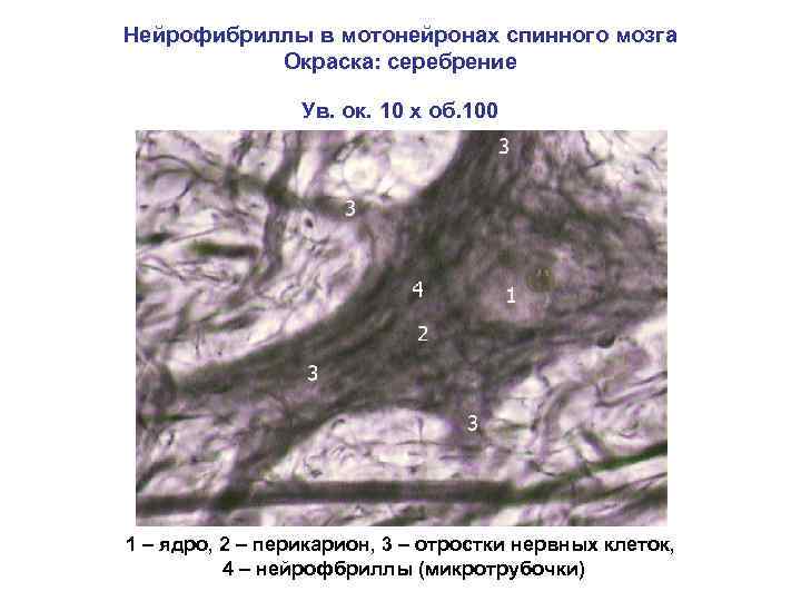 Нейрофибриллы в мотонейронах спинного мозга Окраска: серебрение Ув. ок. 10 х об. 100 1