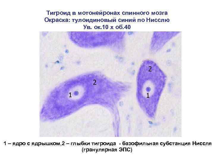 Тигроид в мотонейронах спинного мозга Окраска: тулоидиновый синий по Нисслю Ув. ок. 10 х