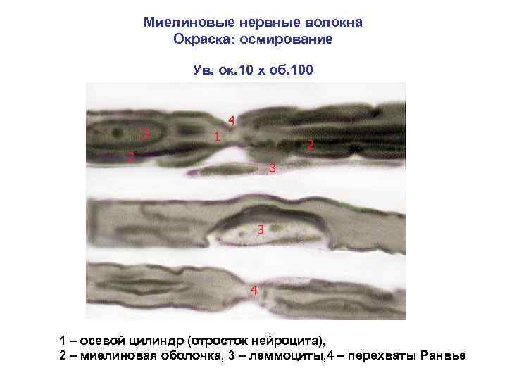 Миелиновые нервные волокна Окраска: осмирование Ув. ок. 10 х об. 100 1 – осевой