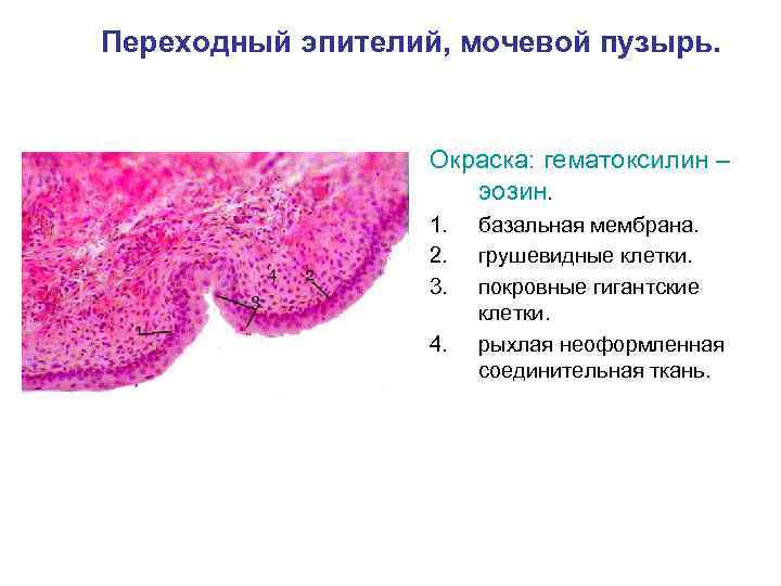 Мочевой пузырь гистология рисунок