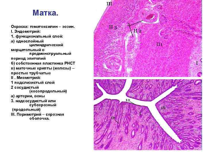 Матка. Окраска: гематоксилин – эозин. I. Эндометрий: 1. функциональный слой: а) однослойный цилиндрический мерцательный