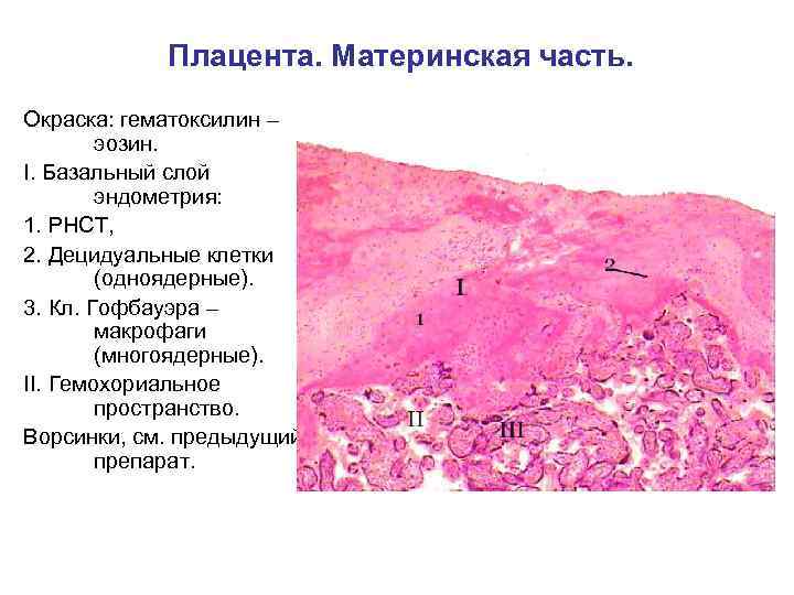 Плацента. Материнская часть. Окраска: гематоксилин – эозин. I. Базальный слой эндометрия: 1. РНСТ, 2.