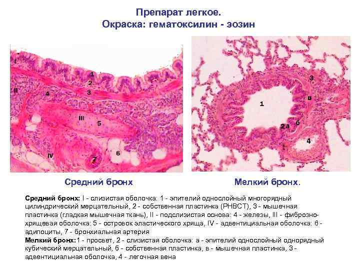 Препарат легкое. Окраска: гематоксилин - эозин Средний бронх Мелкий бронх. Средний бронх: I -