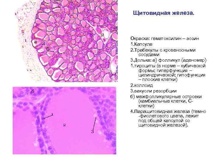 Щитовидная железа. Окраска: гематоксилин – эозин 1. Капсула 2. Трабекулы с кровеносными сосудами 3.