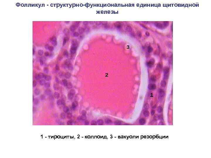 Фолликул - структурно-функциональная единица щитовидной железы 1 - тироциты, 2 - коллоид, 3 -