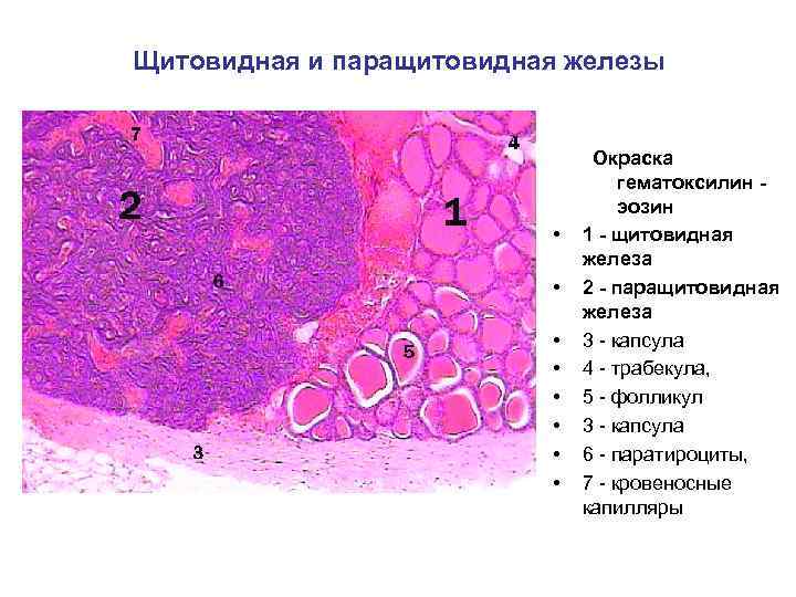 Щитовидная и паращитовидная железы • • Окраска гематоксилин эозин 1 - щитовидная железа 2