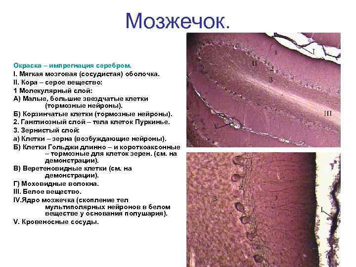 Мозжечок. Окраска – импрегнация серебром. I. Мягкая мозговая (сосудистая) оболочка. II. Кора – серое