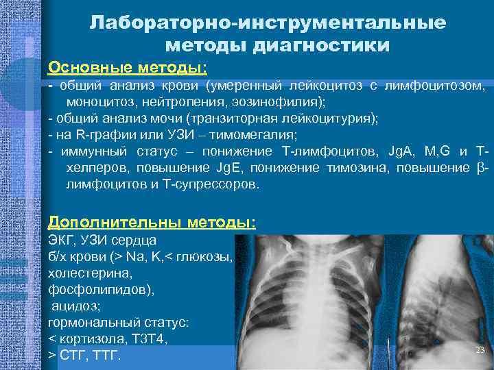 Лабораторно-инструментальные методы диагностики Основные методы: - общий анализ крови (умеренный лейкоцитоз с лимфоцитозом, моноцитоз,